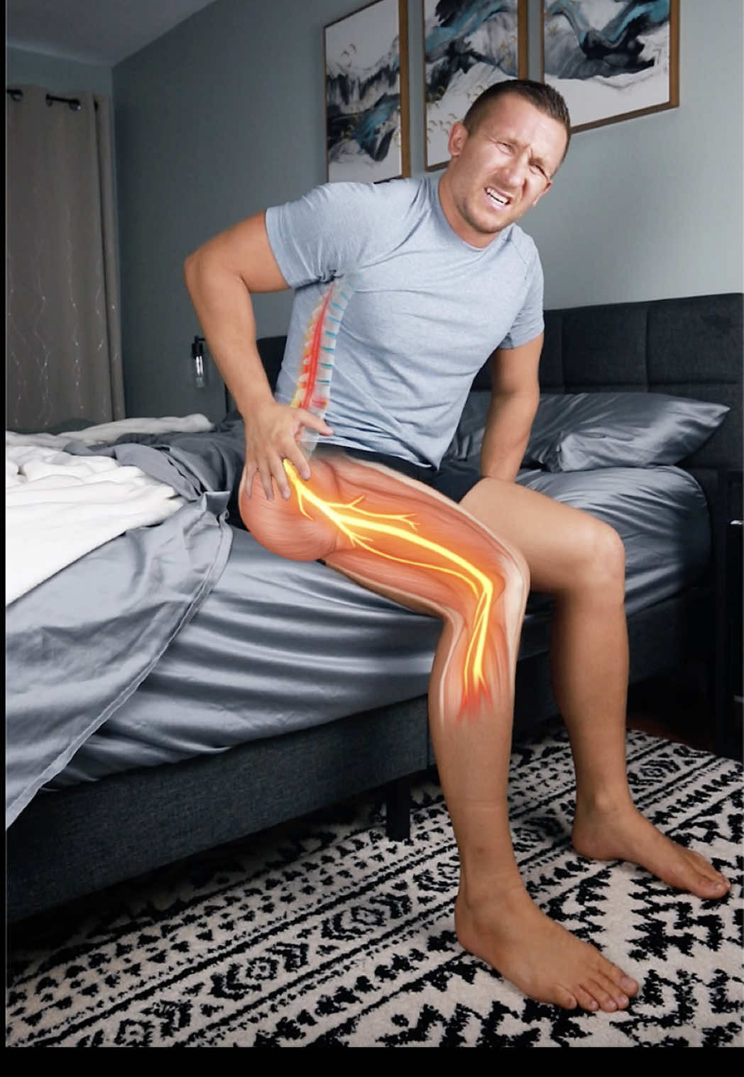 💥 Worse Pain in the Morning? ❌ Low back or leg pain that is worse in the morning is often a sign of a disc herniation Especially if you look 80 years old trying to stand up straight, or its tough putting your socks/shoes on The reason is because over night your discs swell as they resorb more fluid, which means in the morning there is more pressure on the disc bulge or nerve The result is waking up every morning reminded of your pain, and that isn’t fun…. 🔑 But the key is to understand that disc herniations are common and can be resolved with the right approach! 1️⃣ Partial Extensions: Begins to restore extension in the low back and reduce disc pressure 2️⃣ Full Extensions: Restores extension mobility, reverses disc bulges off the nerve 3️⃣ Reverse Plank: Strengthens around the disc aka glutes, low back, and hamstrings to help results last These simple things can drastically help with disc herniation related pain, and leave you waking up feeling better But you likely still need a complete plan specific to you to ensure the results last! ✅ Want to learn how to fix your pain for life? Visit the link in bio and you will get a free disc fix demo with my team! . . . 👣 follow @rehabfix . #discherniation #sciatica #sciaticarelief #sciaticapain #backpain            