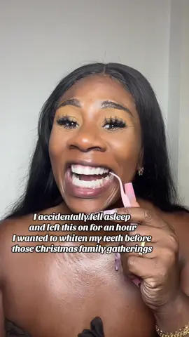 #teethwhitening #tiktokshopblackfriday #tiktokshopcreatorpicks #tiktokshopcybermonday 