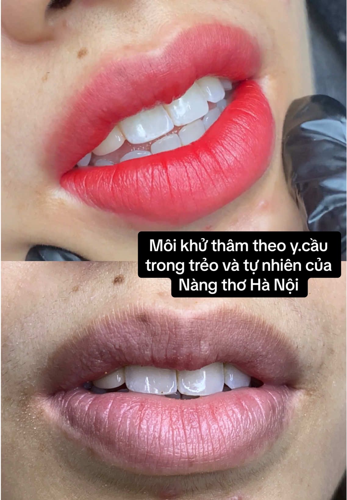 Môi khử thâm theo y.cầu trong trẻo và tự nhiên của Nàng thơ Hà Nội có chuyến công tác 1 tuần tại Nha Trang và có duyên ghé đến em Ngà ,  Gu trong trẻo tự nhiên được các Nàng khách genz ưu chuộng, vì môi sau khử thâm sẽ trong trẻo, giúp các Nàng dùng son, dùng dưỡng sẽ lên chu ẩn màu và tươi tắn hơn nè 💋  #ngocnga #lamdep #khuthammoi #phunmoitunhien #khuthammoinam 