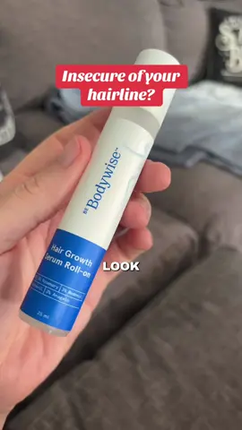 #balding #hairloss #thinninghair #hairgrowth 