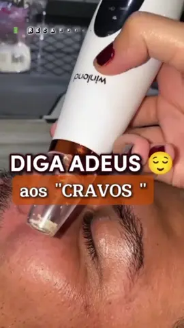 Pele limpa e sem cravos em minutos! Legenda: Adeus cravos e espinhas! Fácil e seguro para sua rotina. #skincare #cravos #espinhas #beleza #achadinho 