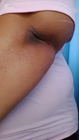 Dark Elbows @KSECRET GLOBAL  #ksecretglowchallenge #ksecret #seoul1988 #retinal 