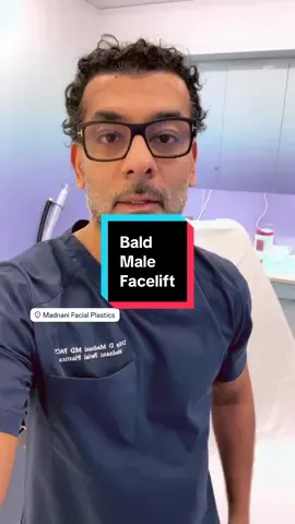 Male facelift in patient who are bald. My surgical plan for the day. 