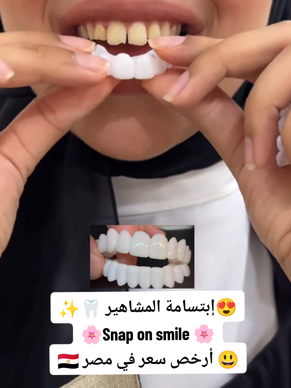 📌 للحجز والأستفسار تواصل معنا علي 01019202217🦷📞