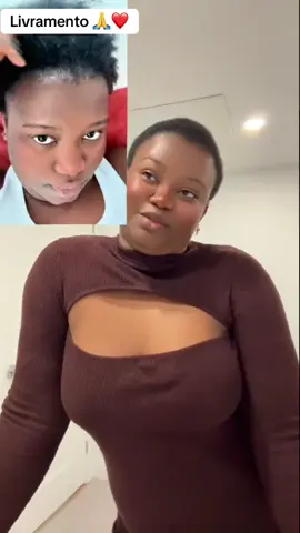 #Tratamentocapilar #Crescimentocapilar #Cabelocrespo #foryoupage❤️❤️ Partilha!