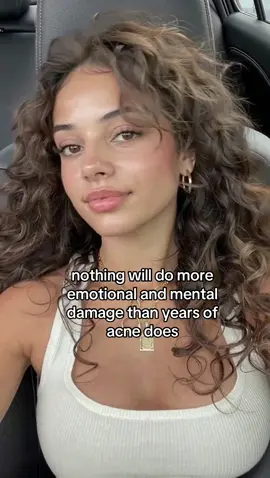 #skincare #acne #skincareroutine #GlowUp 