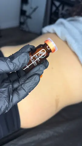 #mesoterapia #drlipo #lipoliquid 