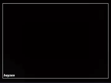 @uglyfacekid #uglyfacekid #rostikfacekid #kishki #edit #killua 