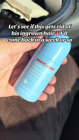 #ingrownhairtreatment #ingrownhair 