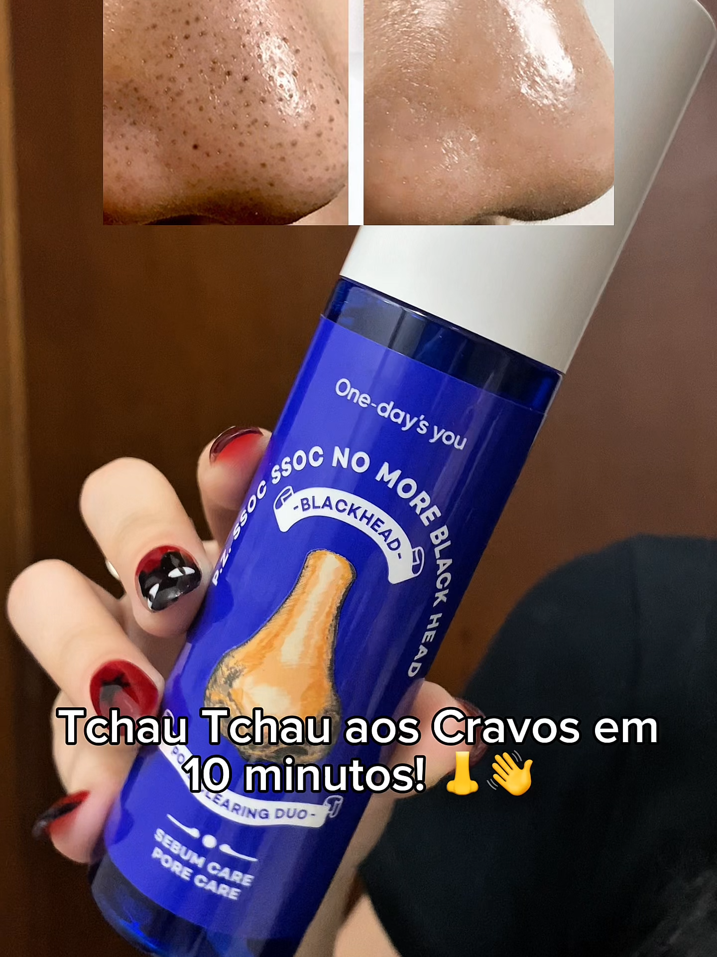🔥 Diga adeus aos cravos sem espremer! 🔥 O removedor de sebo coreano que dissolve os cravos e a oleosidade de forma suave e eficaz — pele limpa, leve e com toque seco desde a primeira aplicação! 💧✨ 💖 Limpeza profunda sem irritar. 🧴 Resultados visíveis já no primeiro uso! Acesse www.kscosmeticos.com.br ou link na bio 📍 . . . #kscosmeticos #koreanskincare #skincarecoreana #kbeautyskincare #produtos #beauty #fyp #fy #fypp