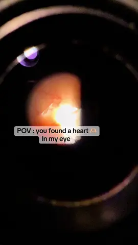 Can you find the heart in my eye? 😍 #viral #foryou #doctorsoftiktok #medicine #optometry 