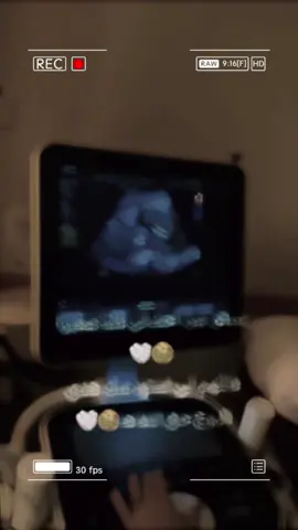 #ماشاءالله🥹💙 