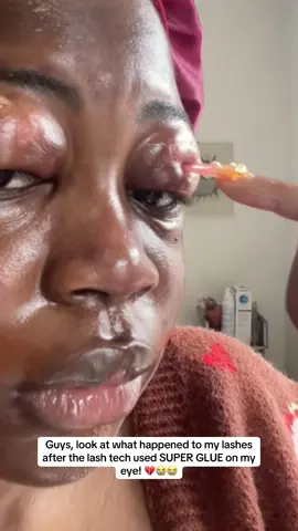 😭 #women #hospital #salon #eyes #beauty  