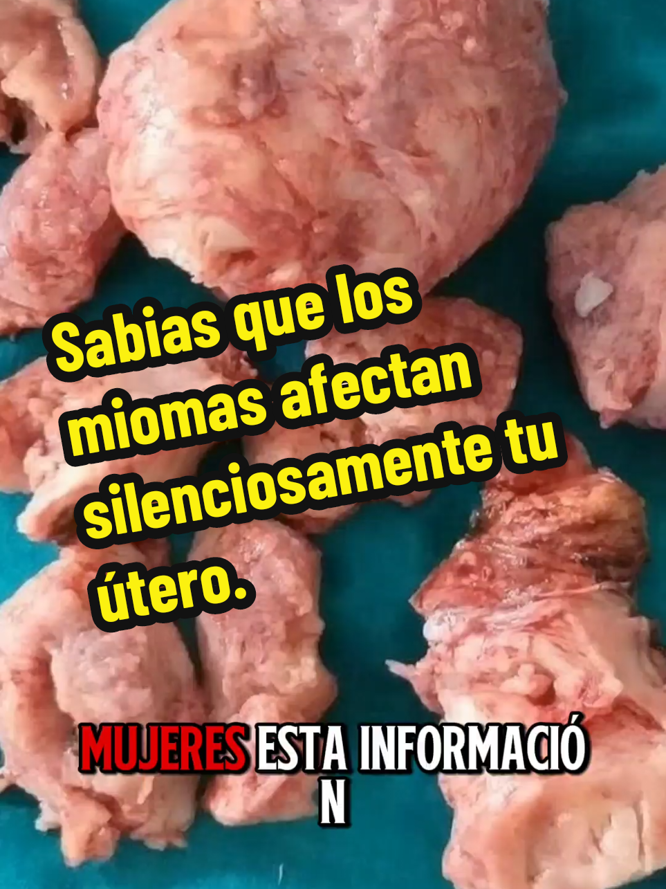 Sabias que los miomas afectan silenciosamente tu útero  #amorpropio #amordemadre #parati #viraltiktok #estadosunidos🇺🇸 