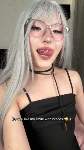 #fyp #asian #braces #cute 