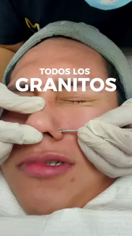 Limpieza facial mientras echamos el Chisme jejeje #skincare #astrodome #limpiezafacialprofunda #puntosnegros 