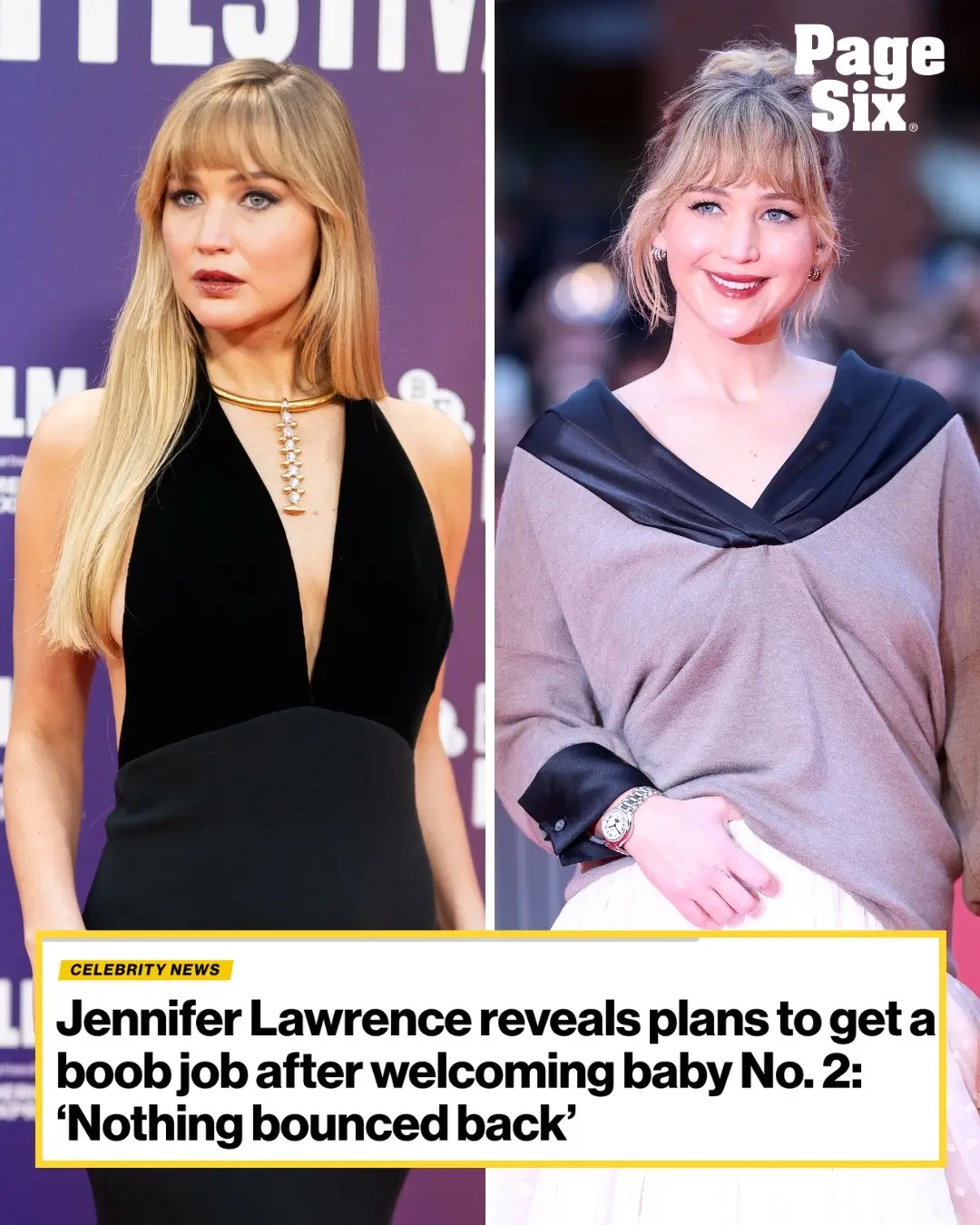 Jennifer Lawrence candidly revealed she’s planning to get a boob job after giving birth to her second child earlier this year. Lawrence said her body wasn’t the same after welcoming baby No. 2 with her husband, Cooke Maroney. “Everything bounced back, pretty much, after the first one,” she said, referring to her first pregnancy with her eldest son, Cy. “Second one, nothing bounced back.” Lawrence shared that she’s planning to film a nude scene on-camera in spring, one year postpartum, but said she would still get the surgery if she wasn’t a famous actress. Lawrence said she gets Botox, but has to make sure she can still use her forehead in order to act. She explained that she doesn’t get fillers because they show on camera, but appeared enthusiastic about maybe one day getting a facelift. 📸: Getty; WireImage