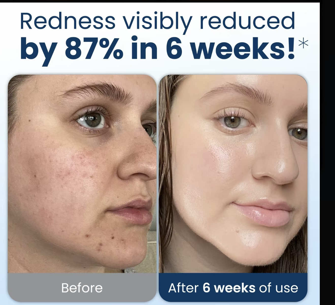 Clean Skin Club Clean Towels XL - Skincare For Sensitive Skin, Makeup Removal, Natural Barrier Protection, Organic Cotton Pad, Facial Cleansing Pads, Dermatologist Approved. @Clean Skin Club #cleanskinclub #cleanskincare #towel #facialcleansing #makeupremoval 