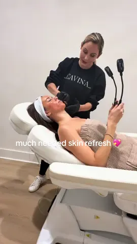 going to be looking extra spooky for Halloween after getting a VI Peel on my face and chest 🎃👻 @cavinawellness  #skincare #chemicalpeel #vipeel #acneskincare #sundamage 