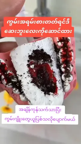 #မြို့ပေါင်း၃၀၀ကျော်အိမ်ရောက်ငွေချေ #ON4t #ယုံကြည်စိတ်ချစွာမှာယူနိုင်ပါတယ်♥️ #ကွမ်းဂျိုးသွားဂျိုးပျောက်ဆေး 