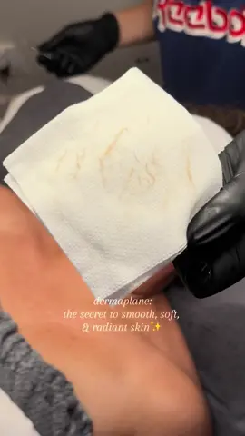 i’ll never stop loving a dermaplane💕💕  #facial #facials #facialasmr #soloesthetician #esthetician #estheticianlife #facialmassage #dermaplaning #dermaplane #skingoals #glowyskin #glowyskincare #skincare #skincareroutine #nashville #murfreesboro #estheticiantiktok #facialtime 