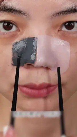 #nosestrips #blackheadremoval #nosebumps #skincareroutine #porestrip #fyp 
