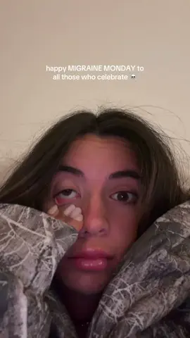 No wonder nobody likes Mondays lol #migraine #monday #mondaymood 