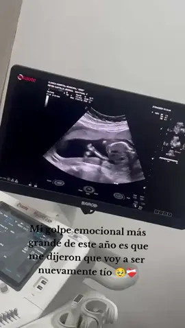 #paratiiiiiiiiiiiiiiiiiiiiiiiiiiiiiii #foryou #fytシ #tio #sobrino😍 