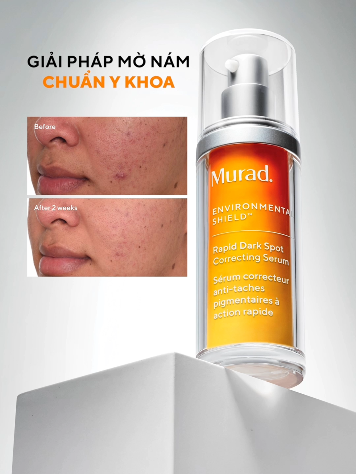 🔬Mờ nám chuẩn y khoa - chuyên gia khuyên dùng!🔬 Được nghiên cứu và thử nghiệm lâm sàng trên hơn 1000 làn da, tinh chất mờ nám và đốm nâu Rapid Dark Spot Correcting Serum giúp làm mờ thâm nám rõ rệt chỉ sau 2 tuần. Trải nghiệm ngay! #muradvietnam #serum #rapiddarkspot