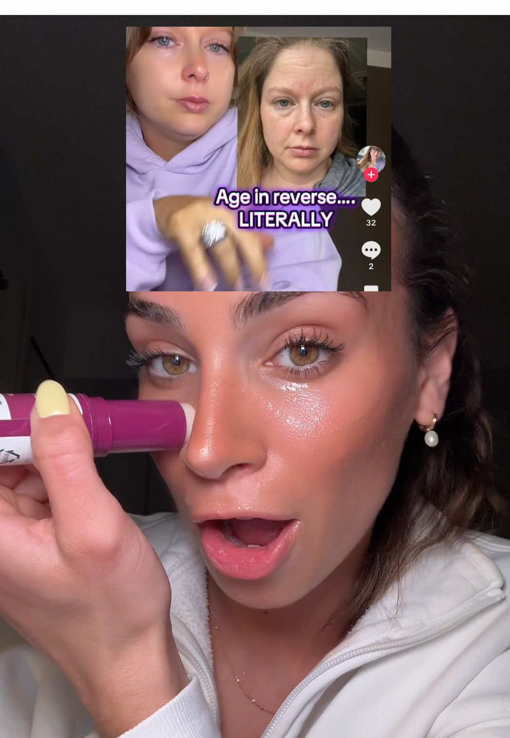 She is boutta put b0tox out of business with this secret... #filler #skincare #antiage #koreanskincare #drmelaxin @Dr.Melaxin Global bye bye crows feet and dark hallowed under eyes✌🏼