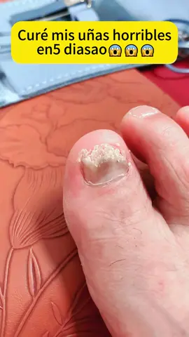 The secret to healthy, beautiful nails! These antifungal patches protect during manicures and daily wear. Should I do a full tutorial? 💅#elaimeifungalnailpatches #resultsmayvary #TikTokShopFallDealsForYou #tiktokmademebuylt #antifungal #fungalnailtreatment #elaimei #fungalnail #results #healthynails #affordable #tiktokshopblackfriday #tiktokshopcybermonday #fyp #nails💅