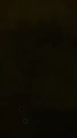 #အရမ်းလွမ်းတယ်ချစ်ရယ်#😔🥀💔 #tiktok #tiktok #fbyツforyou🤍 #😔🥀💔 #fbyツforyou🤍 