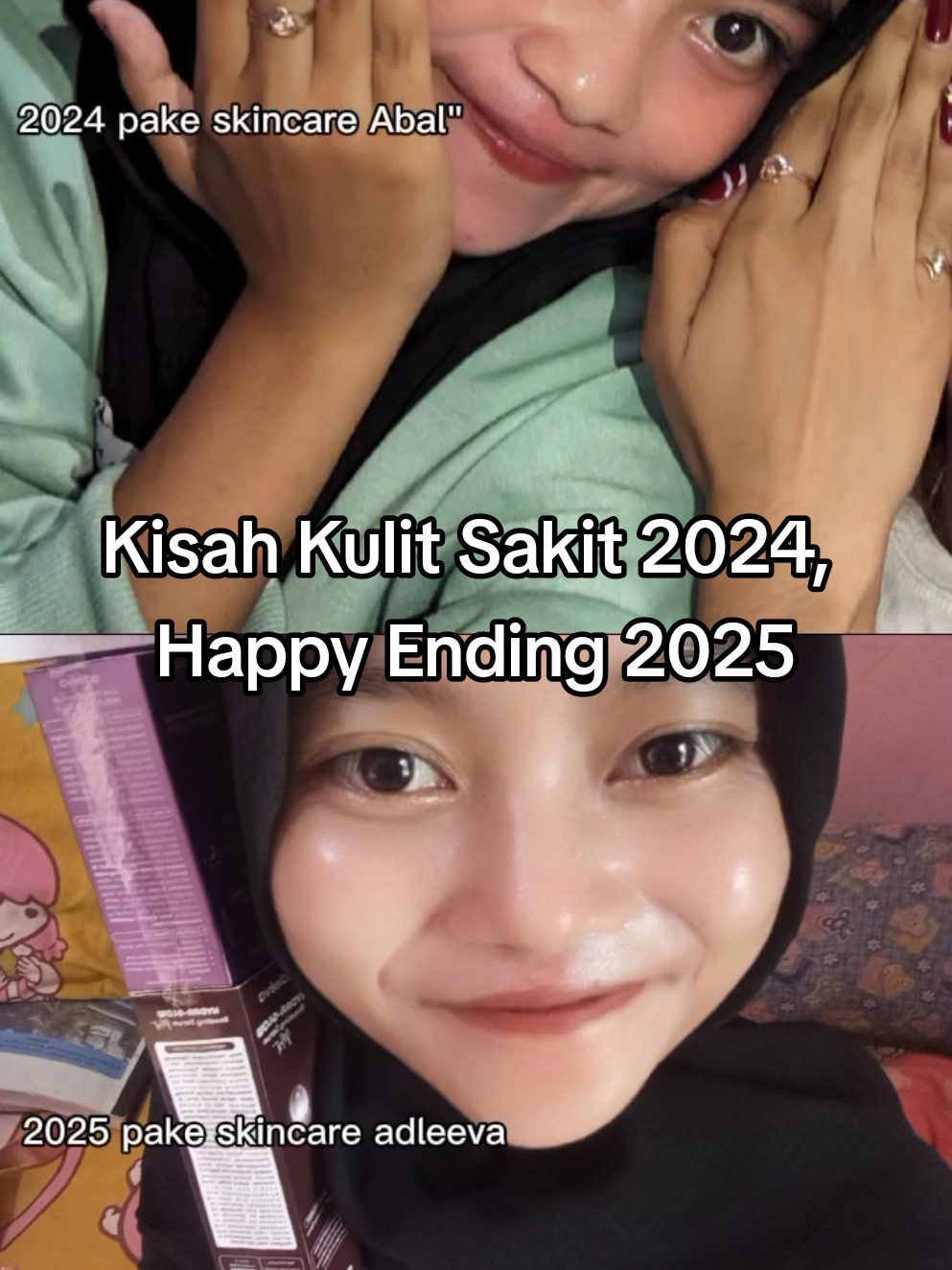 Kulit yang pernah tersakiti di 2024 akhirnya menemukan rumah di 2025. Adleeva yang merawat tanpa drama.#fypdong #beauty #SkincareLokal #skincareroutine #Adleeva @Adleeva Skincare Official ² @Adleeva 