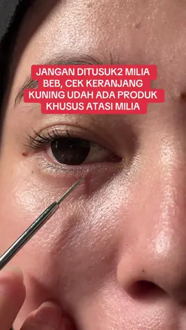 Ambil produknya di keranjang kuning beb‼️ #milia #serummilia #skincaremilia #leikaskincare 