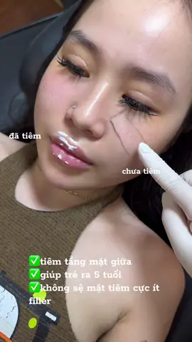 #tangmatgiua #tiemtangmatgiua 