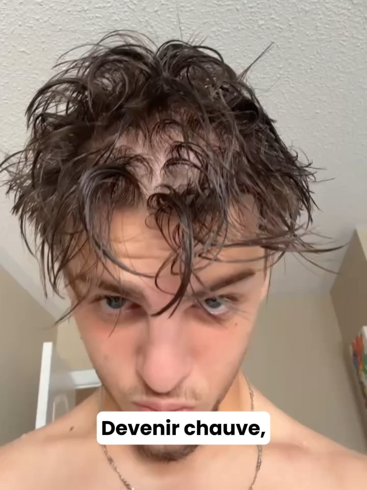 J’ai tout essayé… jusqu’à trouver CE truc qui marche vraiment 😮#cheveux #calvitie #poussedecheveux #hairregrowth #hairregrowthtreatment #hairloss #pertedecheveux