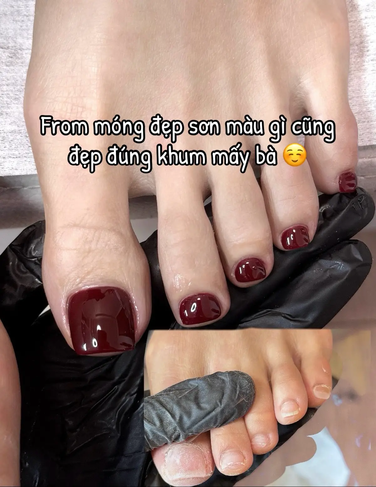 “Trước – sau khác biệt rõ luôn 😍 chăm chút một chút là tự tin hơn hẳn đúng k mấy bà 👌#nailart #nailchan #xuhuong 