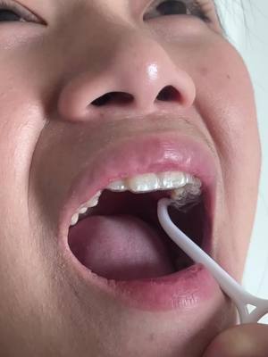 Ratain gigi tanpa behel? Aligner Rata solusinya! bisa ratain gigi dalam 3–6 bulan*. Yuk chat Rata!