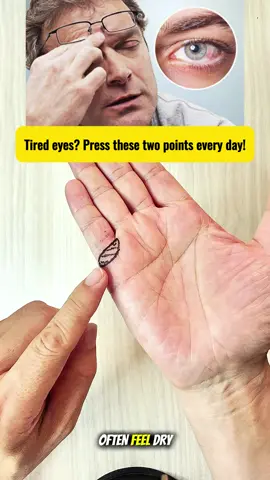 Dry or tired eyes? Just massage these two acupressure points daily to relieve strain and improve clarity 👁 #eyecare #acupressurepoints #naturaltips #wellnessdaily #healthylifestyle