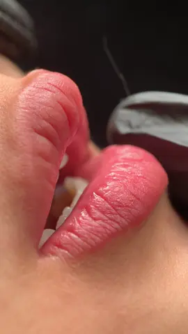 Đã remix còn thêm môi đẹp 🤭🤭 #phunmoitunhien #khuthammoi #phunmoitanvien #phunmoidep #molisebeauty 