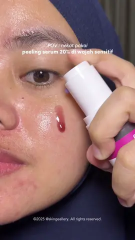 Nekat bgt pake peeling serum 20%🤣. Tapi malah nggak ngerasa cekat cekit?!? Udahnya emang jd haluuss bgt dan di aku gak ada kesan perih atau gimana, afternya juga muka aku gak merah2. Okee bgt sih ini!!  #somethinc #somethincpeelingserum #peelingserum 