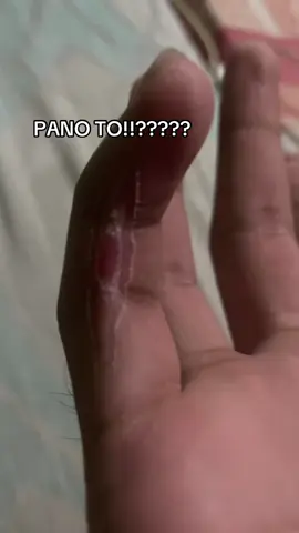 Nabalatan kase, e pinagaling ko syang ganyang direksyon. Edi ayan ayaw na mastraight