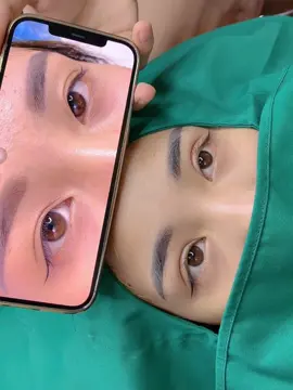 Cắt mó đẹp tại Bắc Ninh #xuhuong2024 #bacninh #cắtmi #sửami #catmidep 