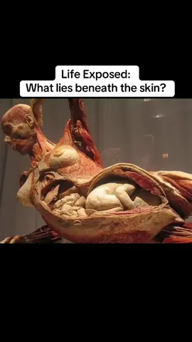 This striking and often debated Body Worlds exhibit shows a pregnant woman and her unborn child, preserved through a process called plastination — a technique that replaces bodily fluids with polymers to permanently preserve real human tissue. While this particular display has stirred ethical discussions about consent, sourcing, who was the person, why did she die, and why the baby wasn’t saved…the purpose of Body Worlds remains rooted in education — to help us understand human anatomy, development, and the interconnectedness of body systems in a way that textbooks alone cannot convey. According to CBS News, the woman was one of more than 200 people who donated their cadavers for use in 