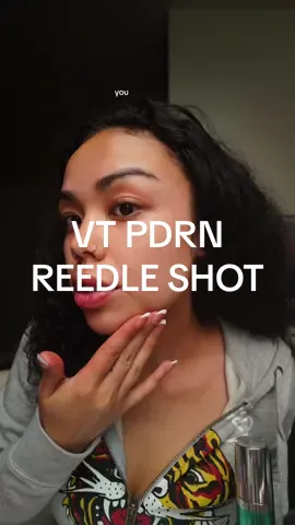 Came on here looking crazy just to show you my results from @VT Cosmetics US lmao #vtcosmetics #reedleshot #skincareroutine #glowyskincare #pdrn 