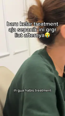 maklum dia pertama kali treatment🙏🏻 #fyp #mydermastory #skincare #kulitsensitif #pentingnyamicrobiome