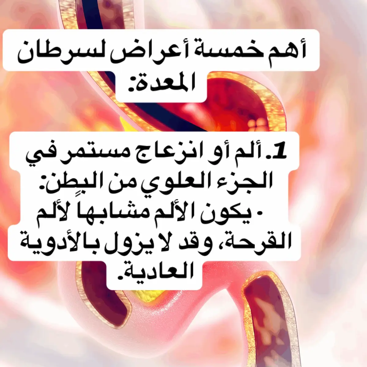 الأسباب وعوامل الخطر لا يوجد سبب واحد محدد، لكن هناك عدة عوامل تزيد من خطر الإصابة: · العدوى ببكتيريا الملوية البوابية: من أهم عوامل الخطر. · النظام الغذائي: الإكثار من الأطعمة المدخنة والمملحة والمخللة، وقلة تناول الفواكه والخضروات. · التدخين وشرب الكحول. · التاريخ العائلي: وجود قريب من الدرجة الأولى مصاب يزيد من الخطر. · السمنة. · الجراحات السابقة للمعدة: مثل استئصال جزء منها لعلاج قرحة سابقة. · بعض الأمراض: مثل فقر الدم الخبيث، والتهاب المعدة الضموري المزمن، وسليلات المعدة.#اكسبلور #نصائح_طبية #سرطان #العرب_في_المانيا #الشعب_الصيني_ماله_حل😂😂 