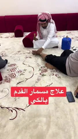 #اكسبلور #ترند #اكسبلورexplore #عرق_النسا #علاج 