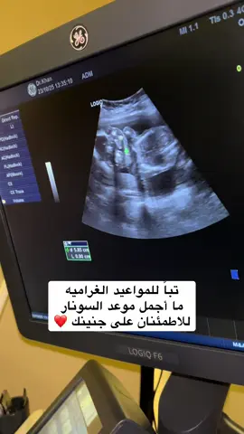 #حوامل_اي_شهر_صرتو_🤰🤰😍🦋 #الشعب_الصيني_ماله_حل😂😂 #ترندات_تيك_توك #فلوقات_تيك_توك #ربي_لاتذرني_فردا_وانت_خير_الوارثين #السعوديه🇸🇦💚 #السعوديه🇸🇦💚 #حوامل #تجارب #اكسبلورexplore #ترندات #تأخر_الحمل #اعراض_الحمل #سونار_الحمل #سونار 