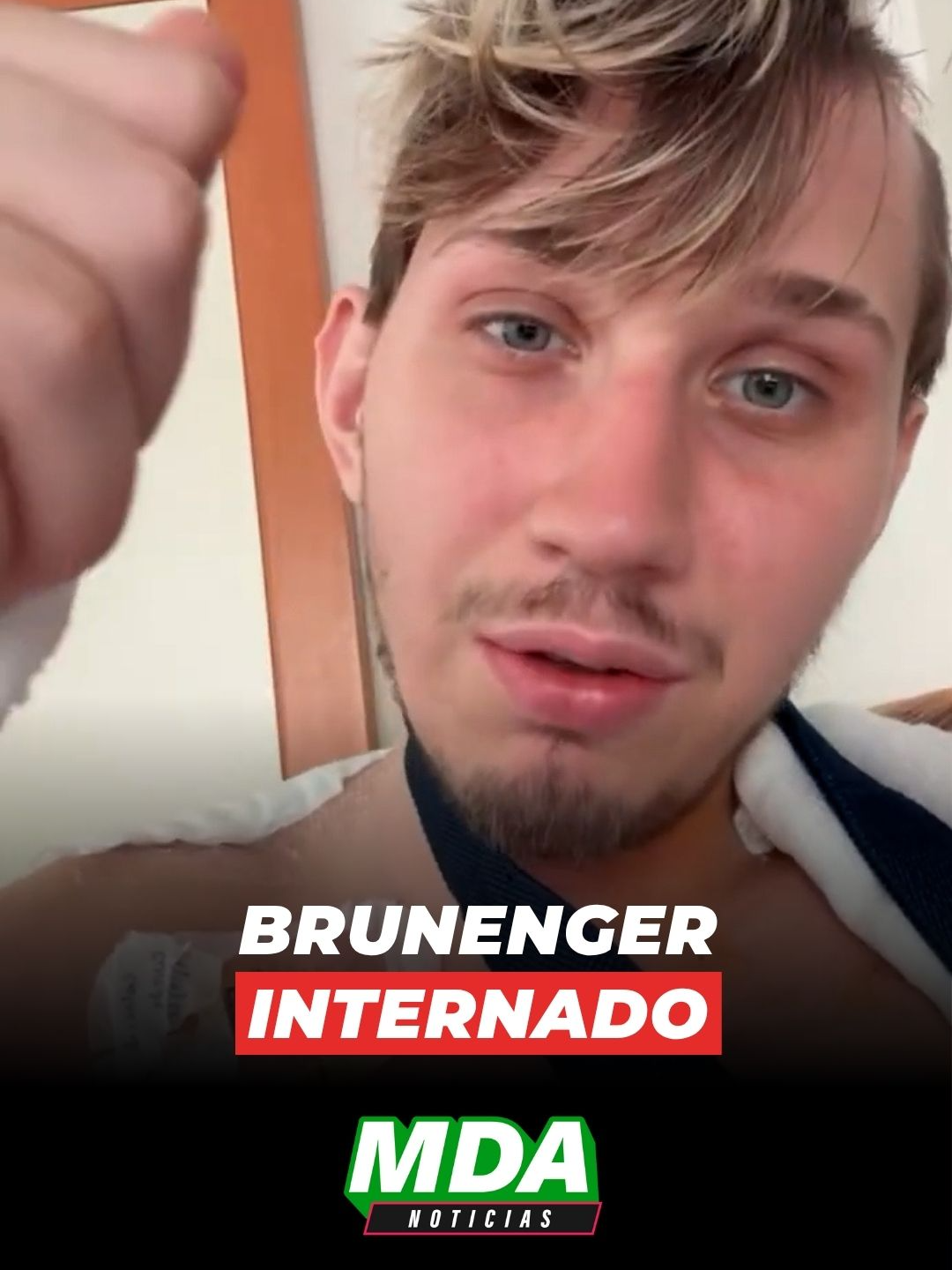 BRUNENGER tuvo una COMPLICACIÓN y está en TERAPIA INTENSIVA: “Voy a salir adelante”